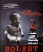 Bolesť (slimbox)
