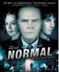 Normal